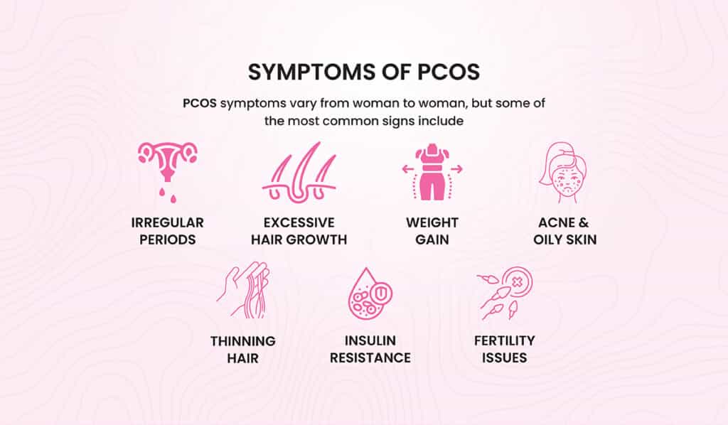 PCOS In Pakistan